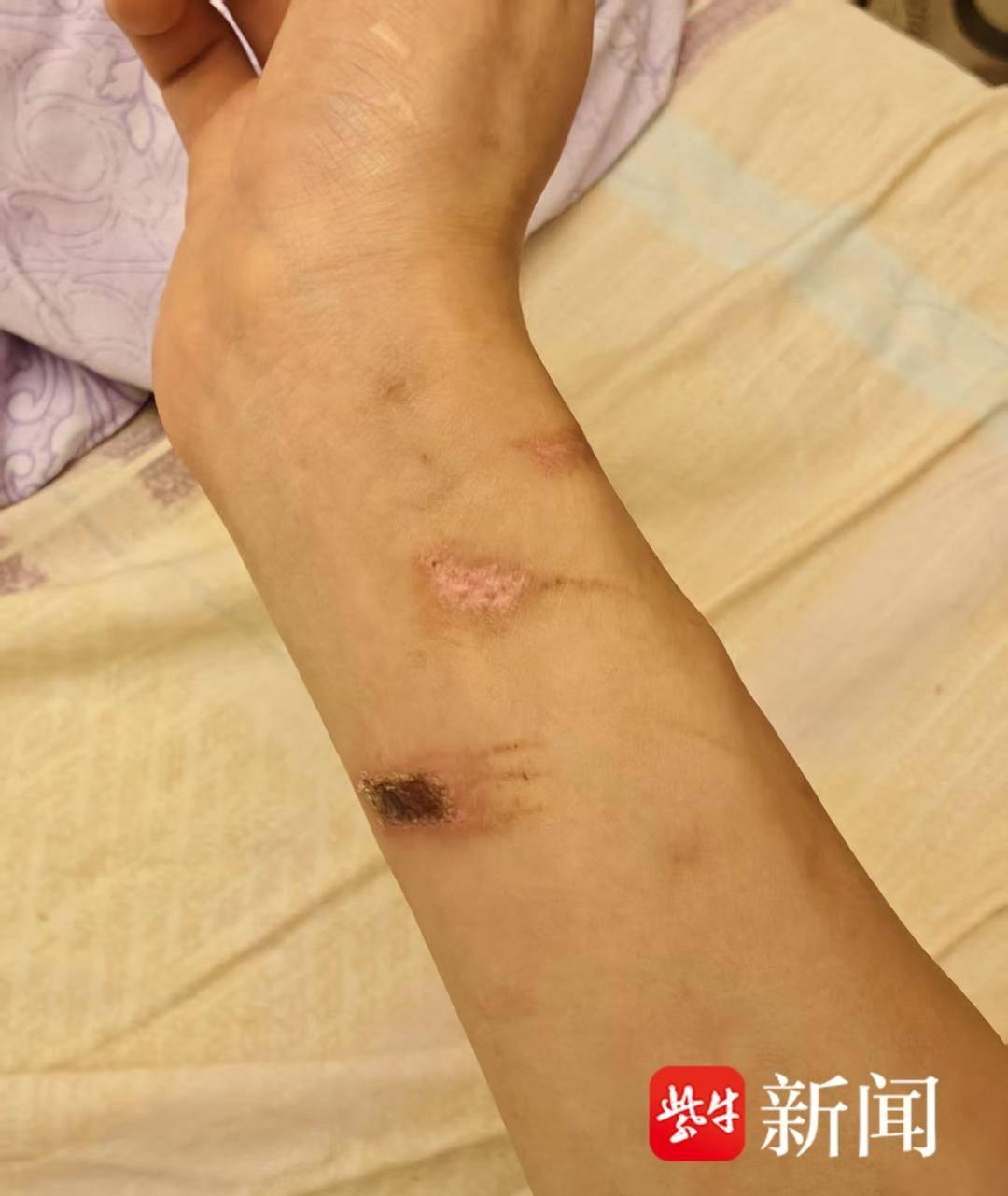 21岁小伙因熬夜被绑至重庆特训学校8天校方回应:正依法配合调查(图3)
